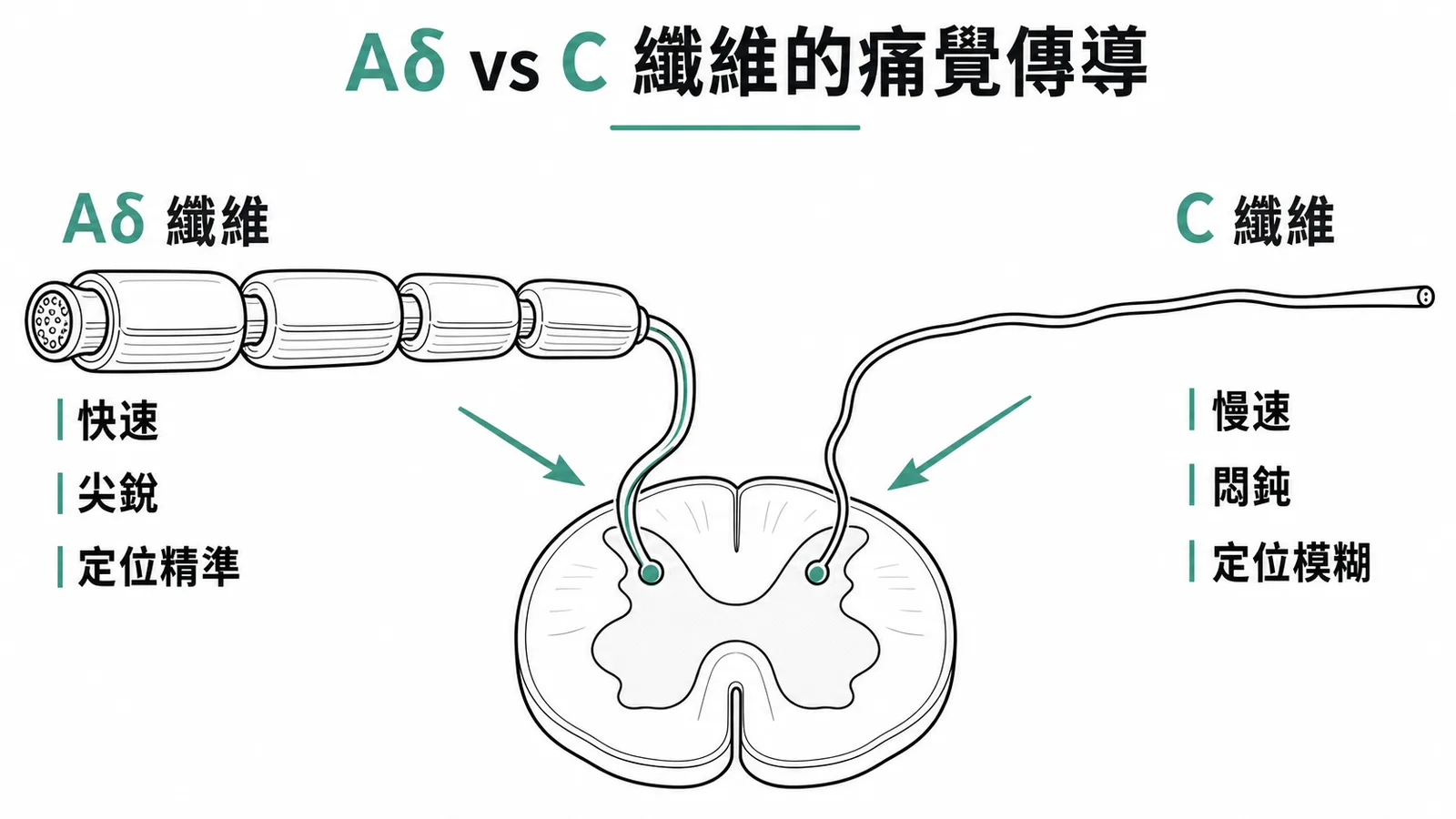 Aδ纖維傳快速精準痛覺與C纖維傳慢速模糊痛覺的對照