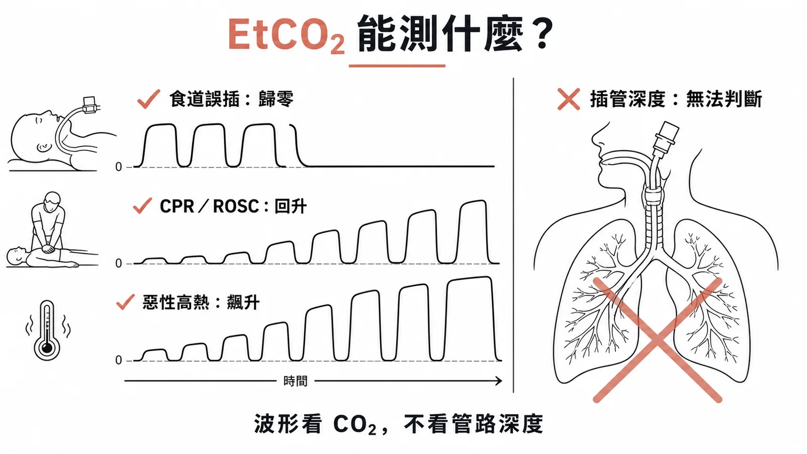 EtCO2可偵測食道誤插管、CPR品質及惡性高熱,但無法判斷插管深度