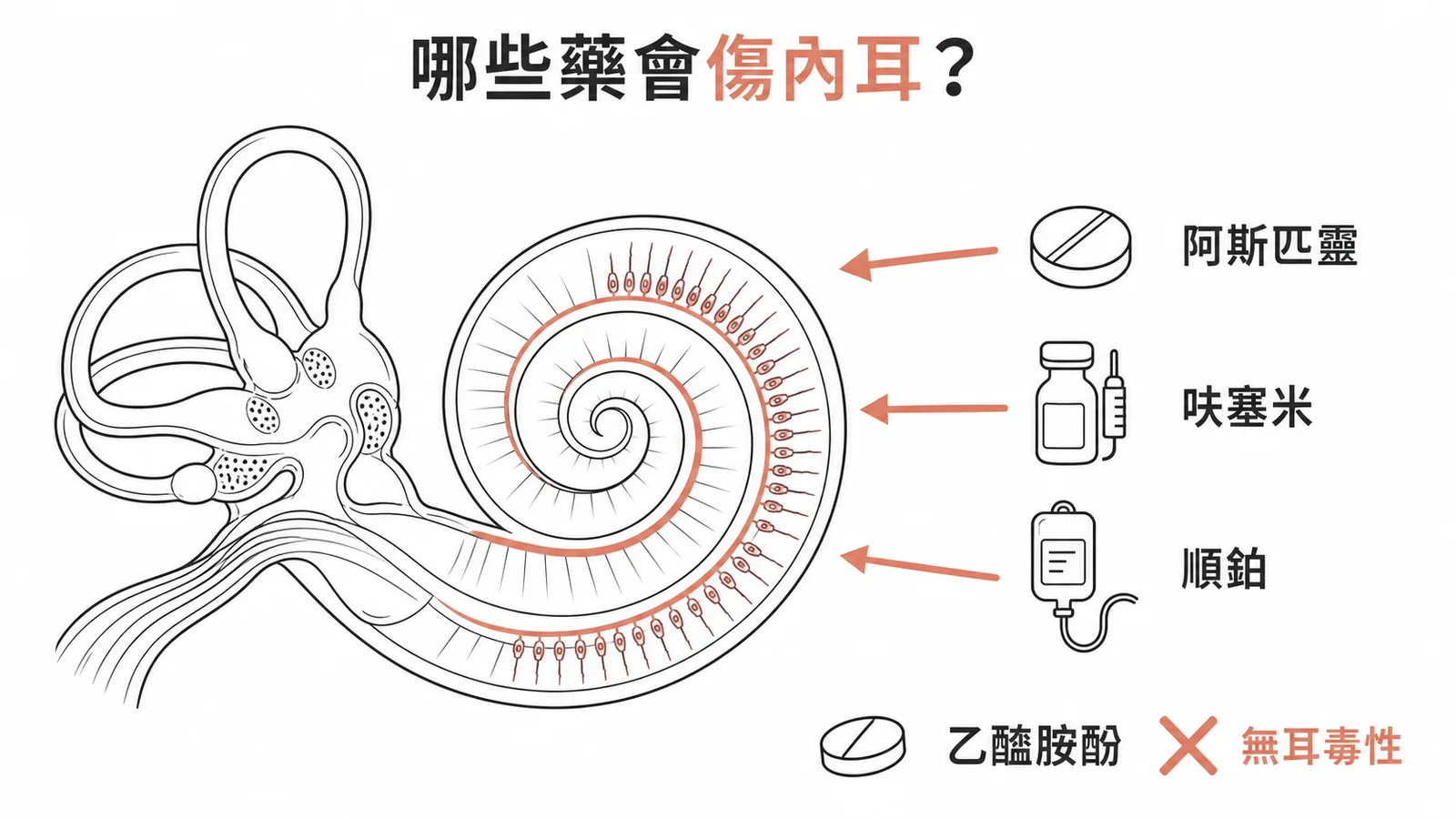 常見耳毒性藥物：阿斯匹靈、呋塞米、順鉑；乙醯胺酚無耳毒性