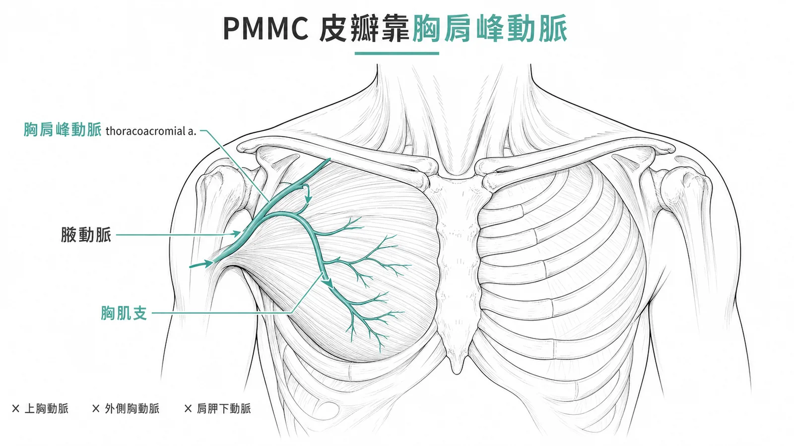 胸大肌皮瓣血管供應來自胸肩峰動脈胸肌支