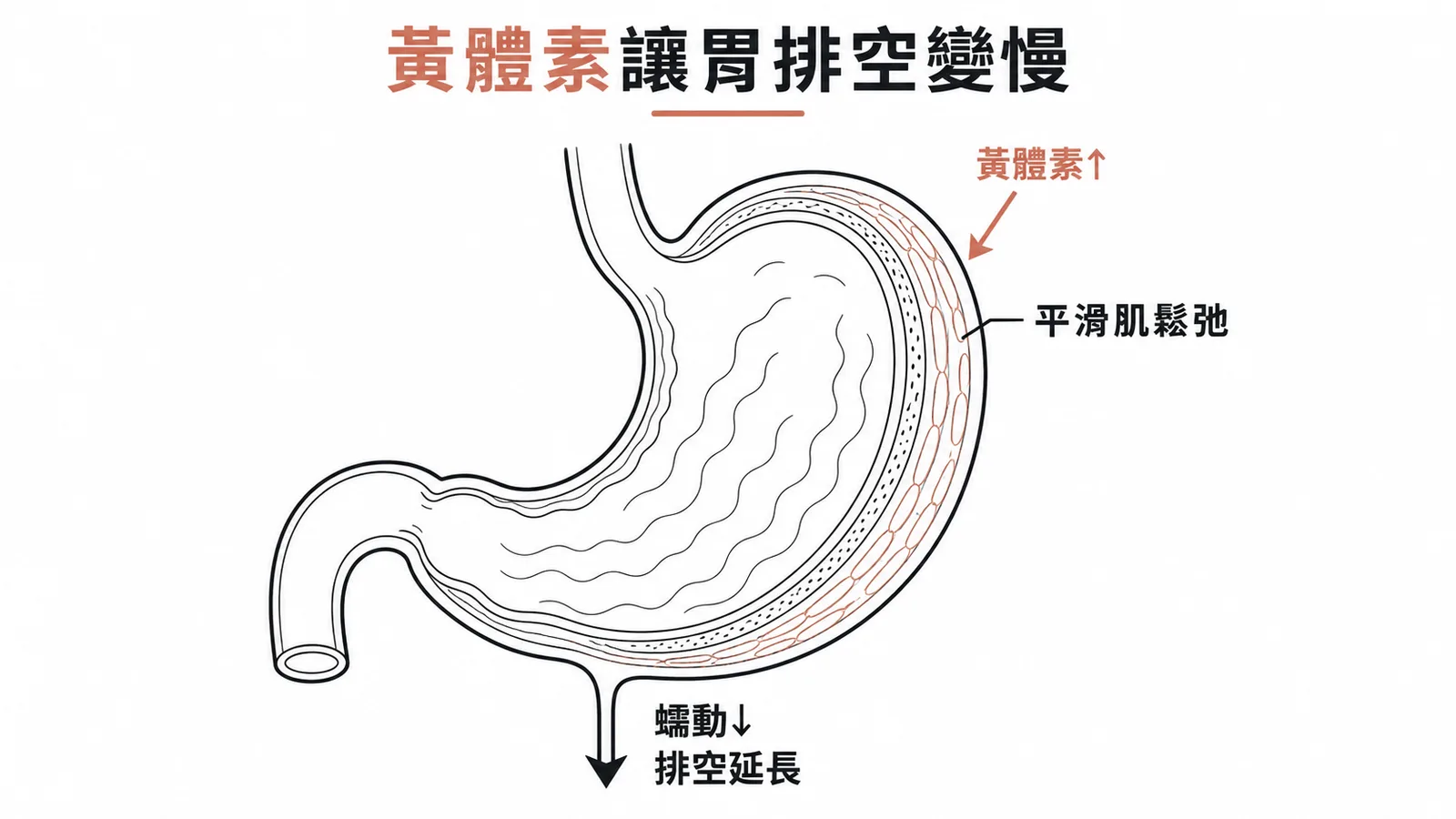 黃體素使胃平滑肌鬆弛,導致蠕動減慢、排空延長