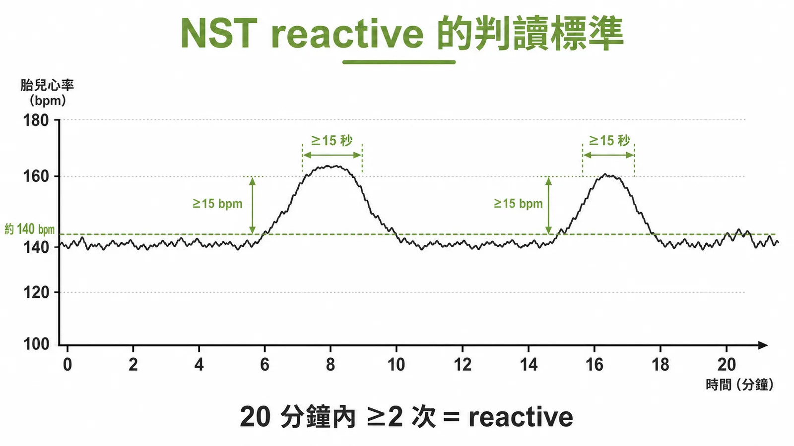 NST reactive 標準：20 分鐘內至少 2 次心率加速 ≥15 bpm 且持續 ≥15 秒