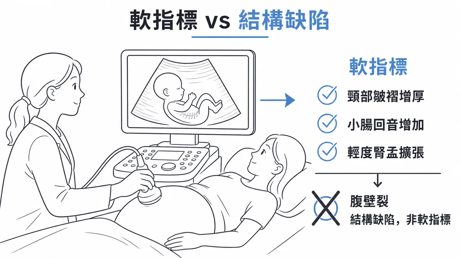 唐氏症軟指標包括頸部皺褶增厚、小腸回音增加、腎盂擴張,腹壁裂為結構缺陷非軟指標