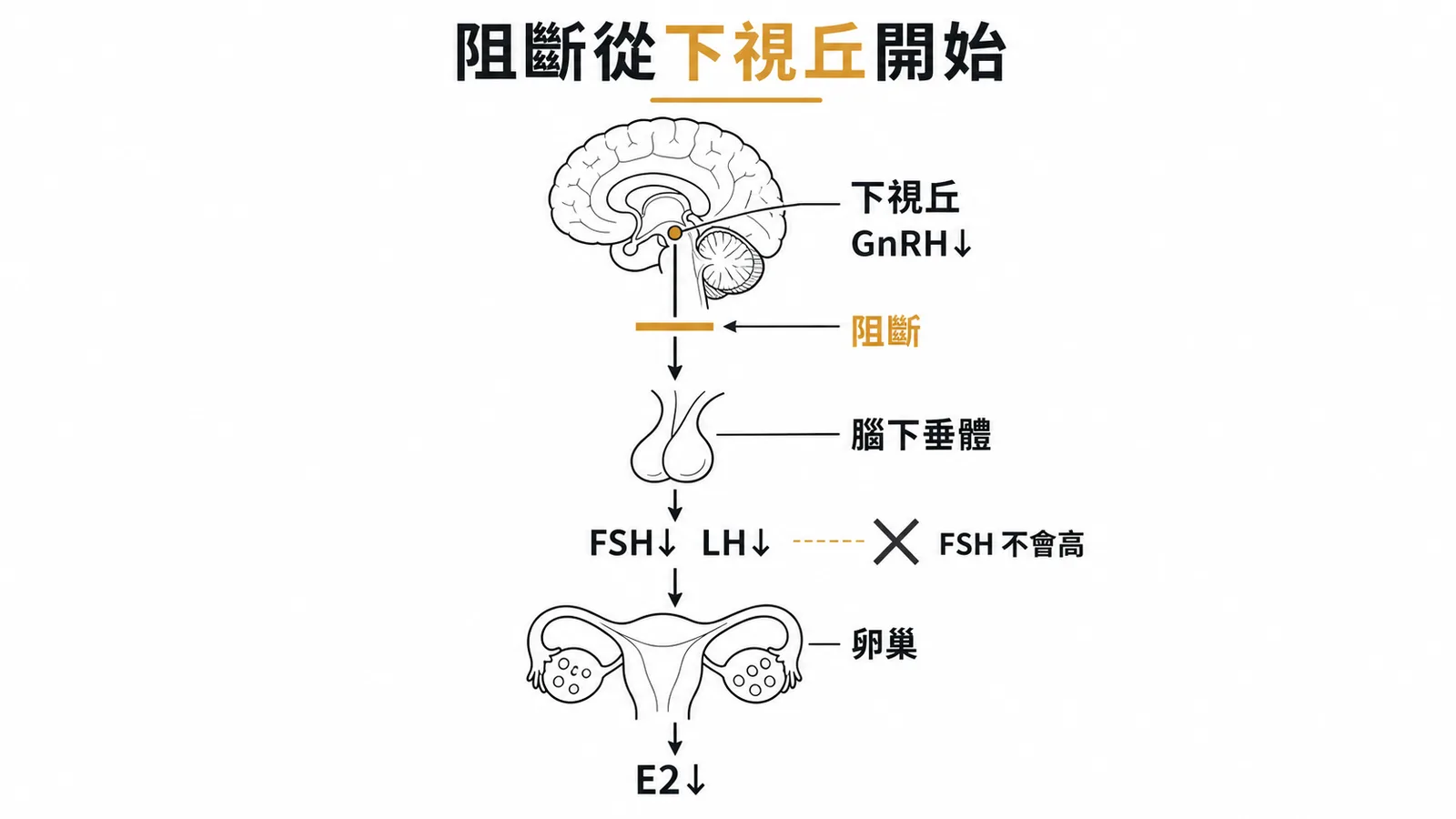 Kallmann 症候群 HPG 軸阻斷:下視丘 GnRH↓ 導致 FSH/LH↓,FSH 不會高