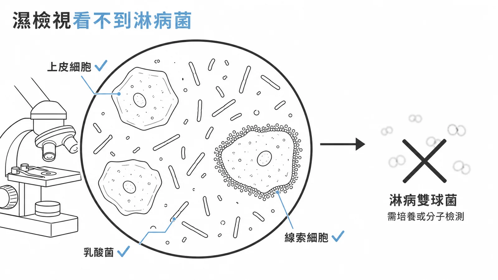 濕檢視可見上皮細胞、乳酸菌、線索細胞，但看不到淋病雙球菌