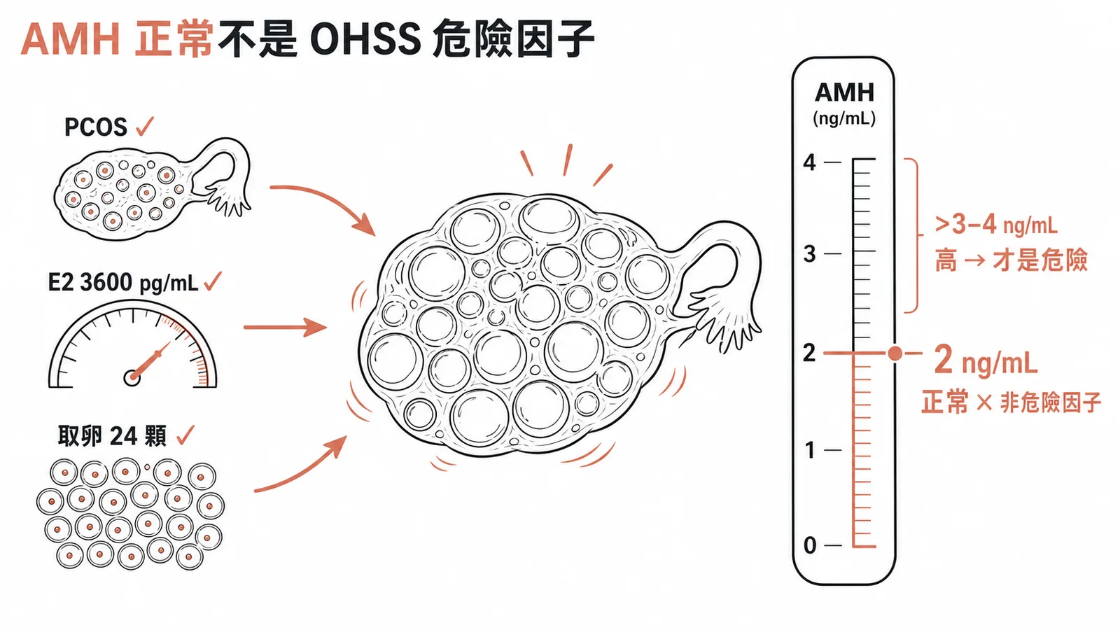 OHSS 危險因子對照:AMH 2 ng/mL 屬正常範圍,非危險因子