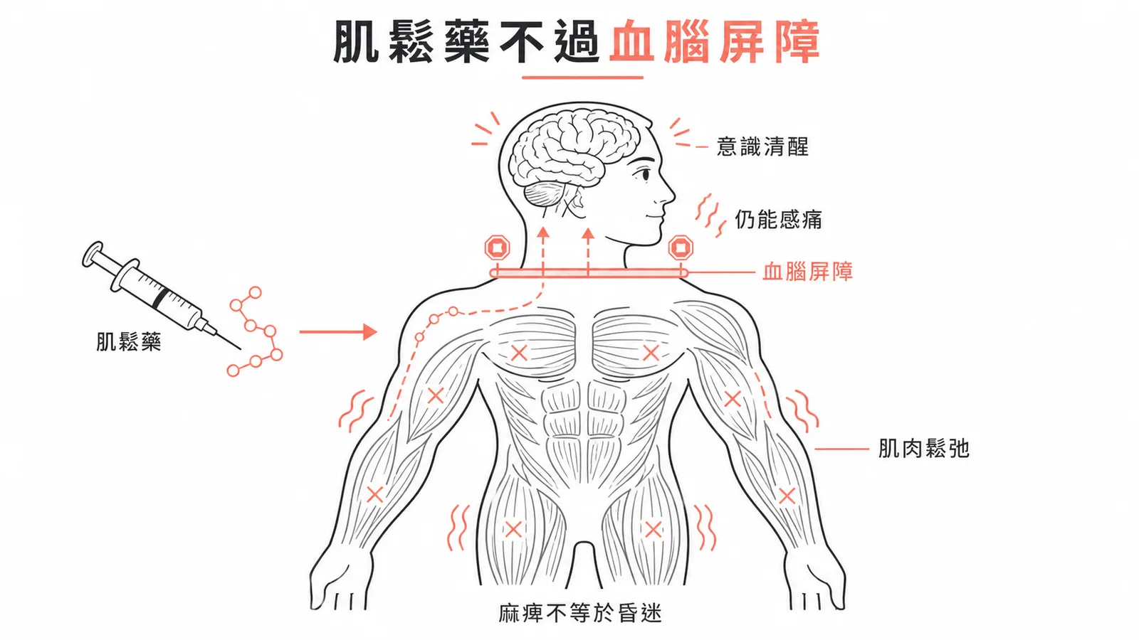 神經肌肉阻斷劑只鬆弛肌肉不影響意識
