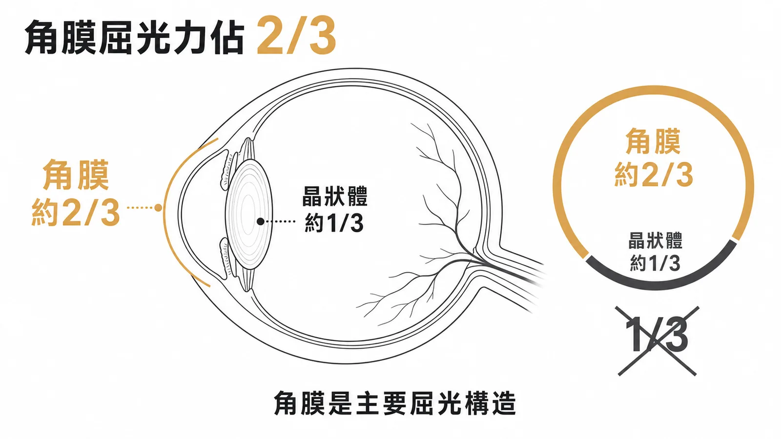角膜屈光力佔眼球總屈光度三分之二的比例示意圖