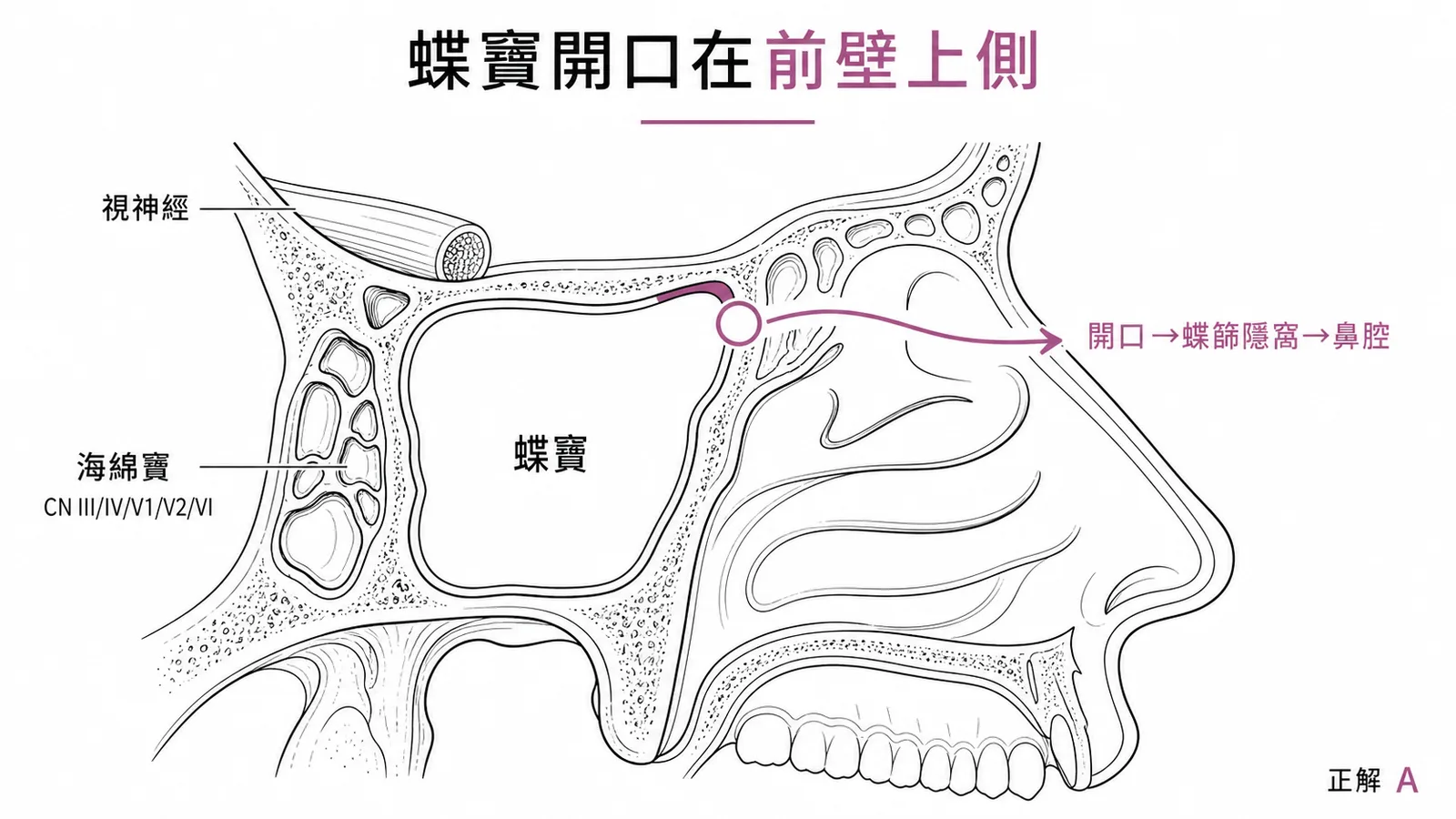 蝶竇解剖與周圍重要結構的相對位置