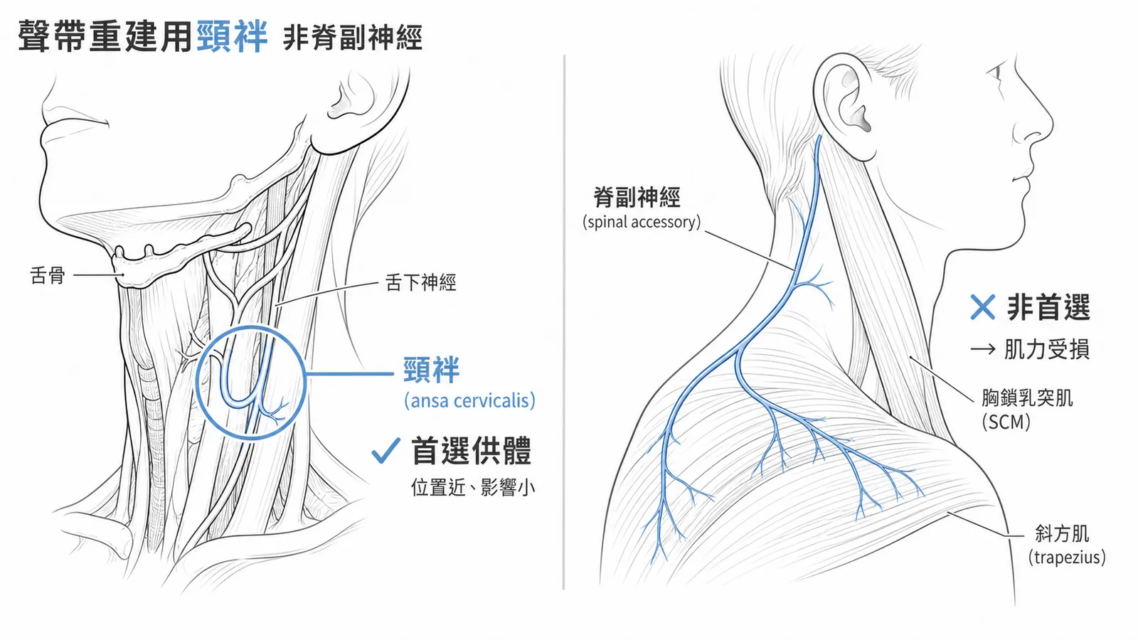 聲帶神經重建用頸袢分支而非脊副神經