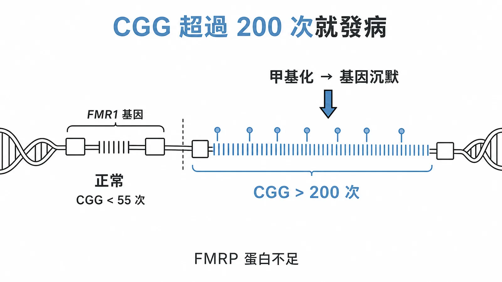 X 染色體脆折症 FMR1 基因 CGG 重複超過 200 次導致基因失活示意圖