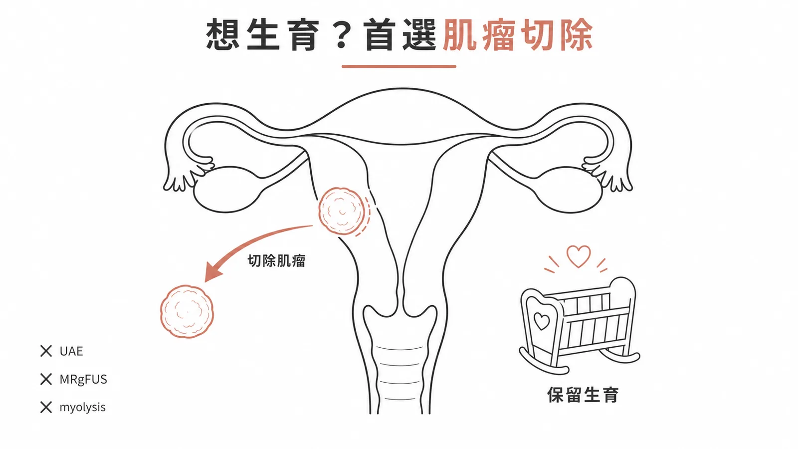 有生育需求的子宮肌瘤患者首選肌瘤切除術