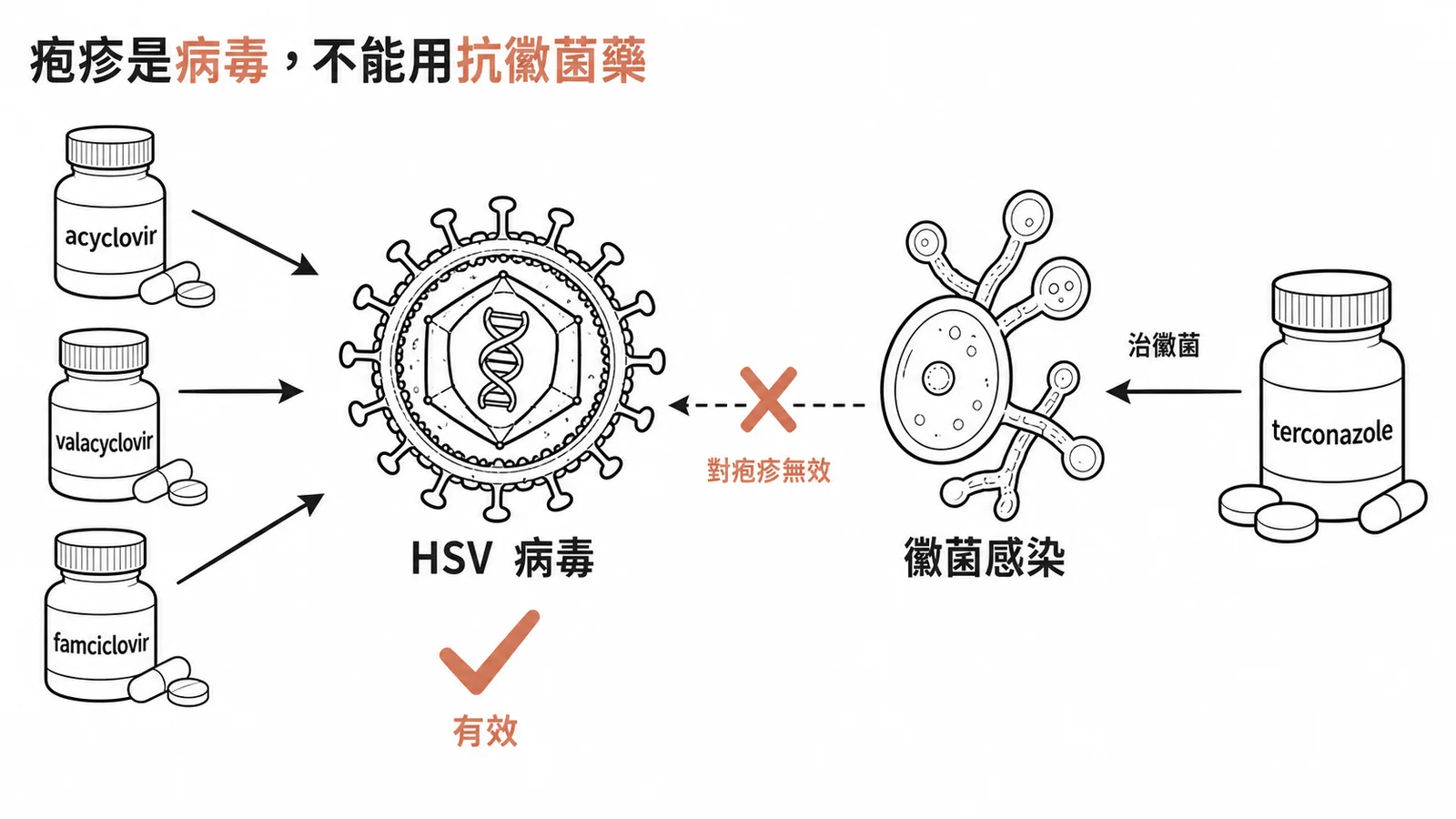 生殖器疱疹用抗病毒藥而非抗黴菌藥