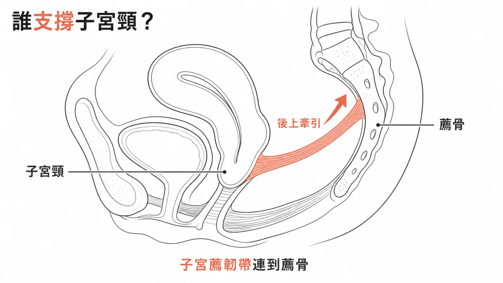 子宮薦韌帶從子宮頸後方連接薦骨,提供子宮頸向後上方的牽引支持
