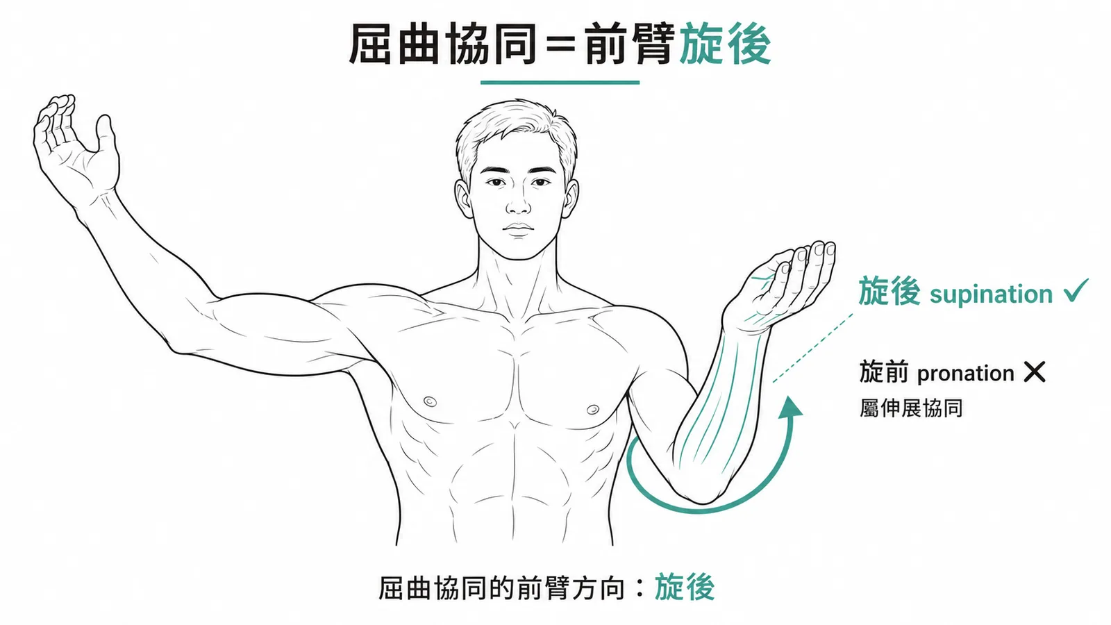 上肢屈曲協同動作中前臂是旋後而非旋前,旋前屬於伸展協同