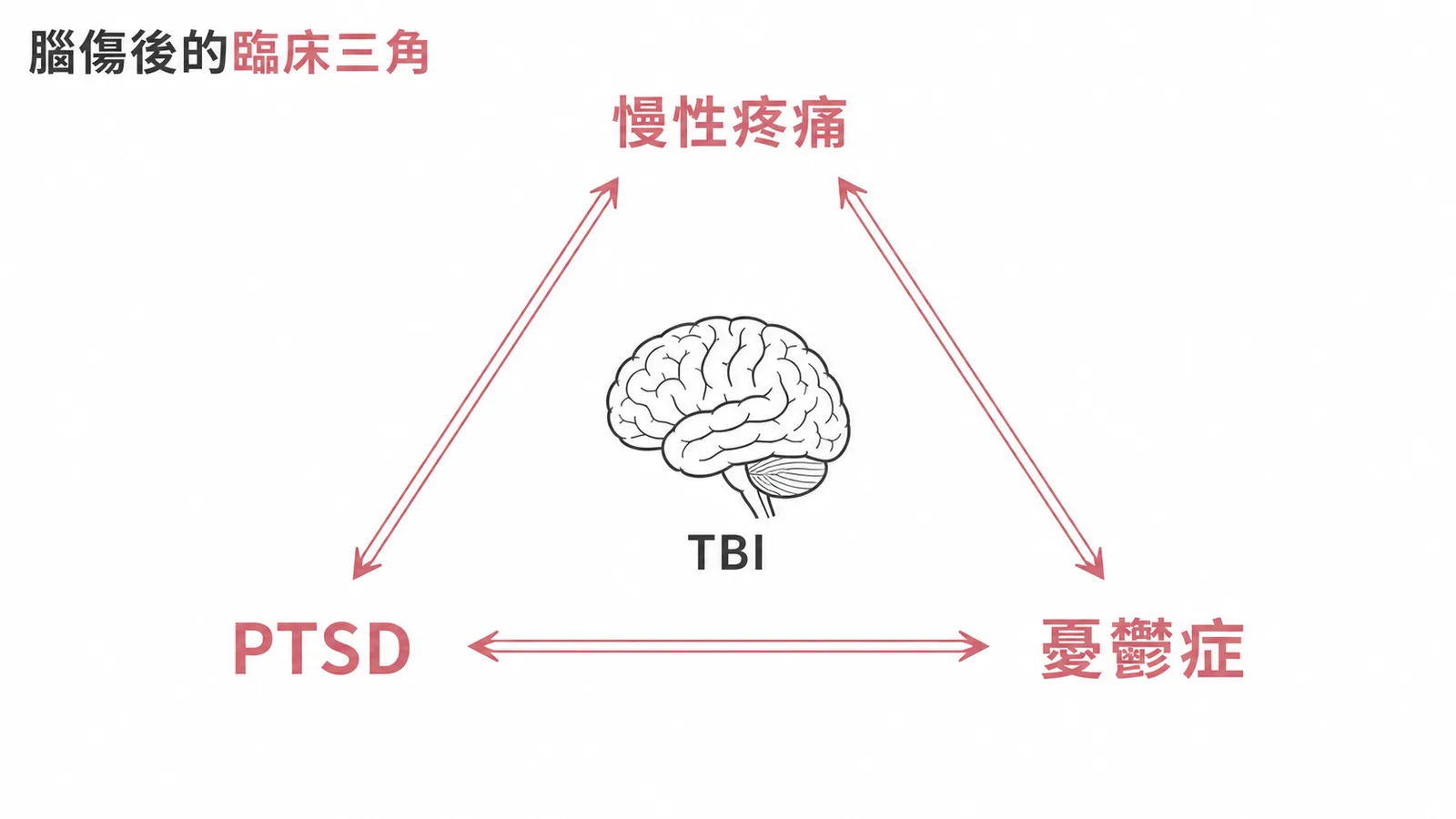 腦傷後臨床三角:慢性疼痛、創傷後壓力症與憂鬱症三者相互加重形成惡性循環