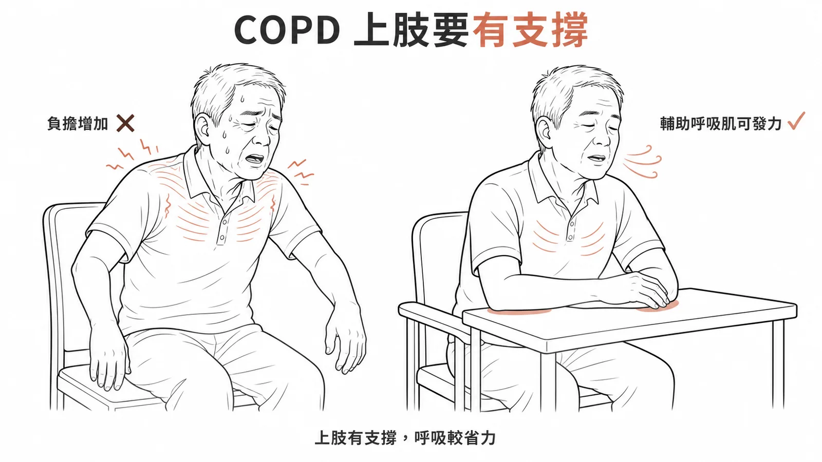 COPD 病人上肢應有支撐,懸空會增加肩胸肌肉負擔讓呼吸更困難