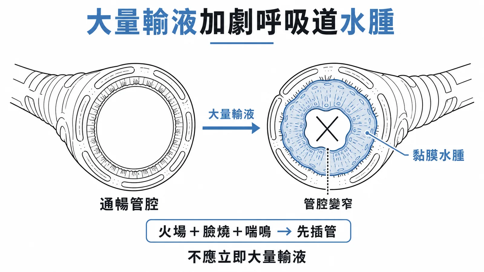 火場吸入性損傷首要保護呼吸道,大量輸液反而加劇水腫