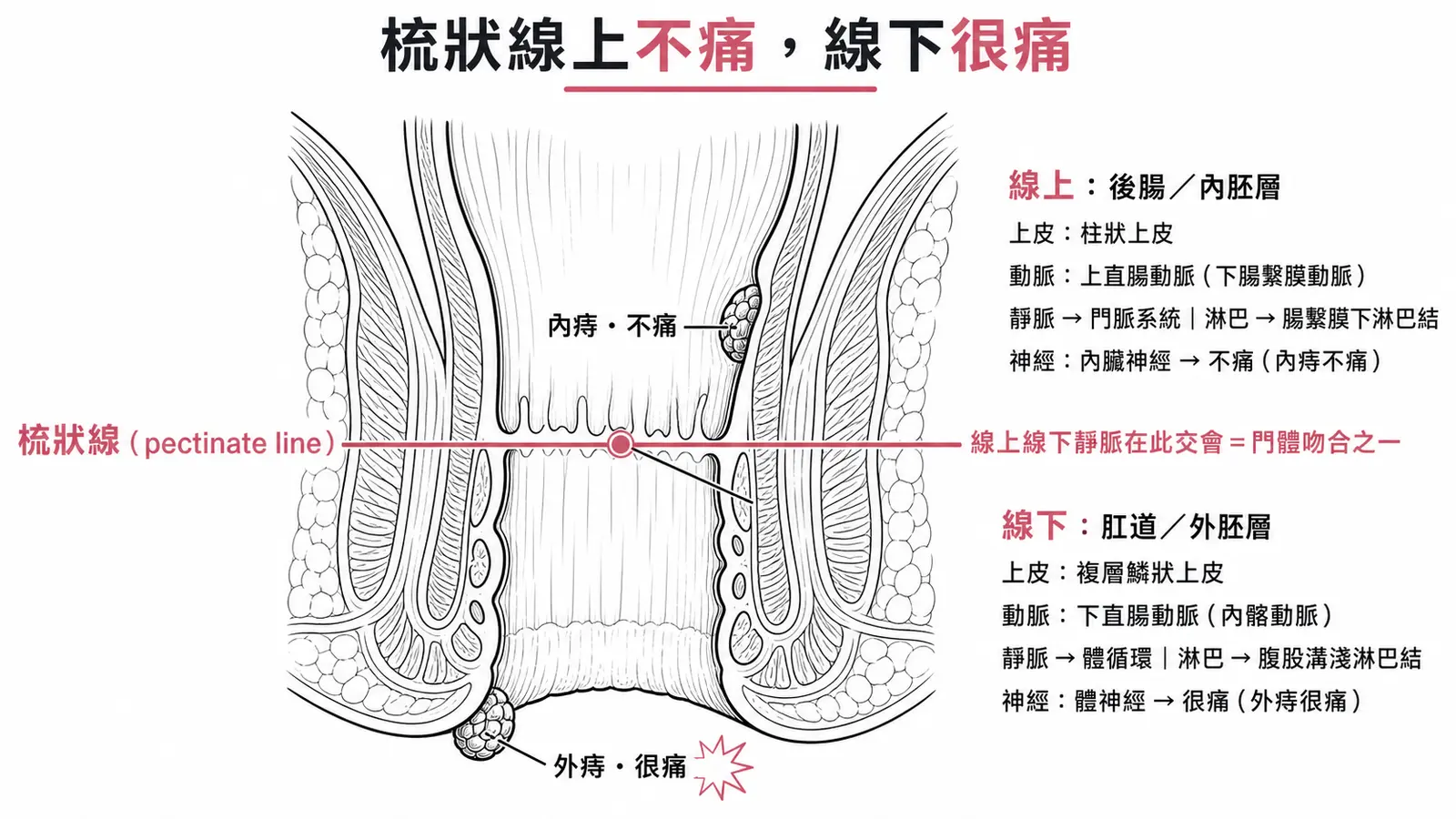 梳狀線上下對照圖：線上屬後腸（內胚層），柱狀上皮、上直腸動脈（來自下腸繫膜動脈）、靜脈回門脈、淋巴回腸繫膜下淋巴結、內臟神經支配所以內痔不痛；線下屬肛道（外胚層），複層鱗狀上皮、下直腸動脈（來自內髂動脈）、靜脈回體循環、淋巴回腹股溝淺淋巴結、體神經支配所以外痔很痛