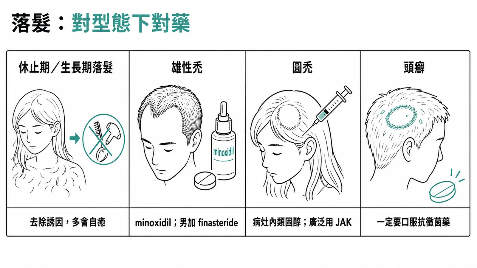 落髮依類型治療：休止期／生長期落髮找出並去除誘因、多自癒；雄性禿用局部 minoxidil、男性可加口服 finasteride；圓禿用病灶內類固醇或口服 JAK 抑制劑；頭癬一定要口服抗黴菌藥