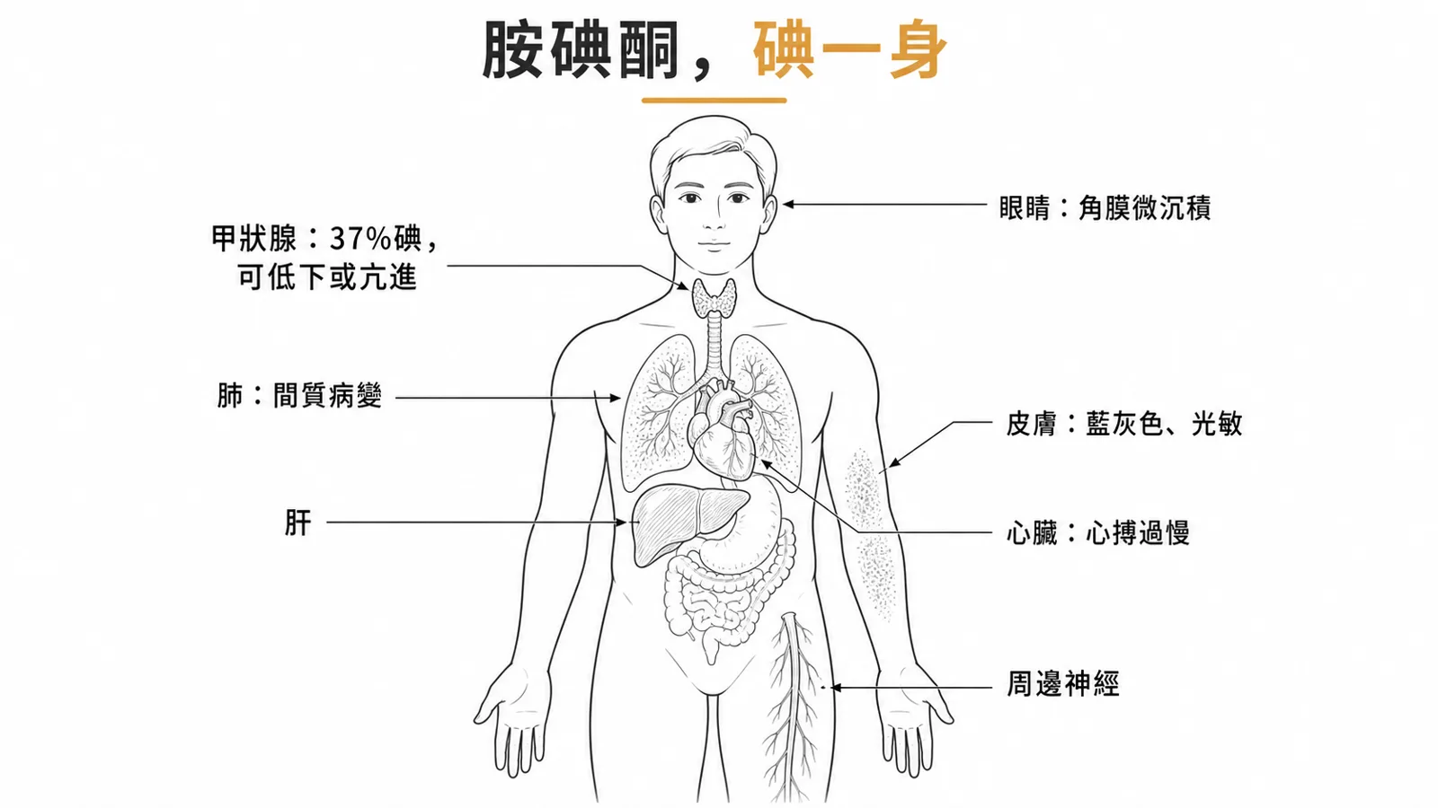 amiodarone 多器官毒性：甲狀腺、肺間質病變、肝、角膜微沉積、藍灰皮膚與光敏、周邊神經、心搏過慢