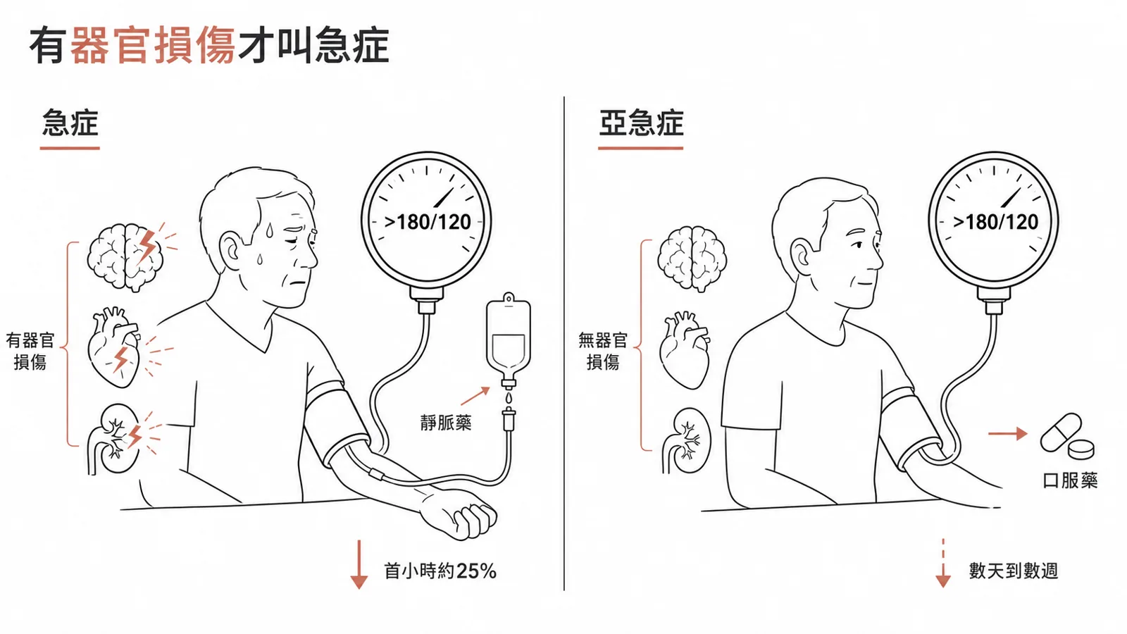 高血壓急症有急性器官損傷、用靜脈藥、第一小時降約 25%；亞急症無器官損傷、口服藥數天漸降