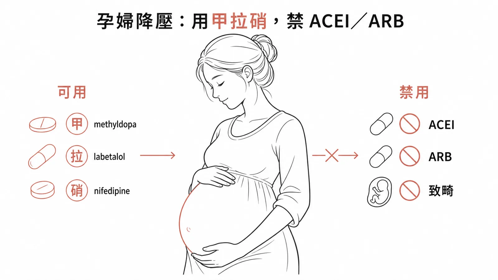 妊娠高血壓安全用藥：methyldopa、labetalol、nifedipine；ACEI 與 ARB 致畸禁用