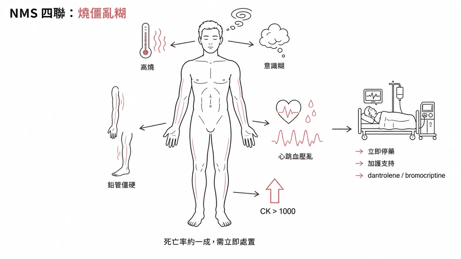 神經抑制劑惡性症候群 NMS 四聯徵:高燒、鉛管僵硬、自律不穩、意識改變加 CK 上升,治療停藥加 dantrolene