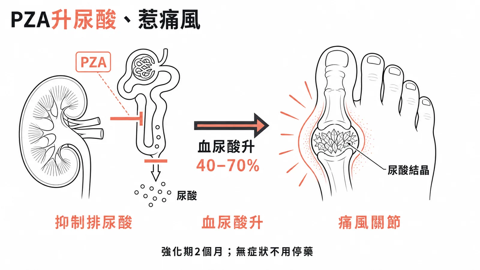 pyrazinamide 抑制腎小管排尿酸、造成高尿酸血症(40–70%),少數誘發急性痛風;只用強化期 2 個月