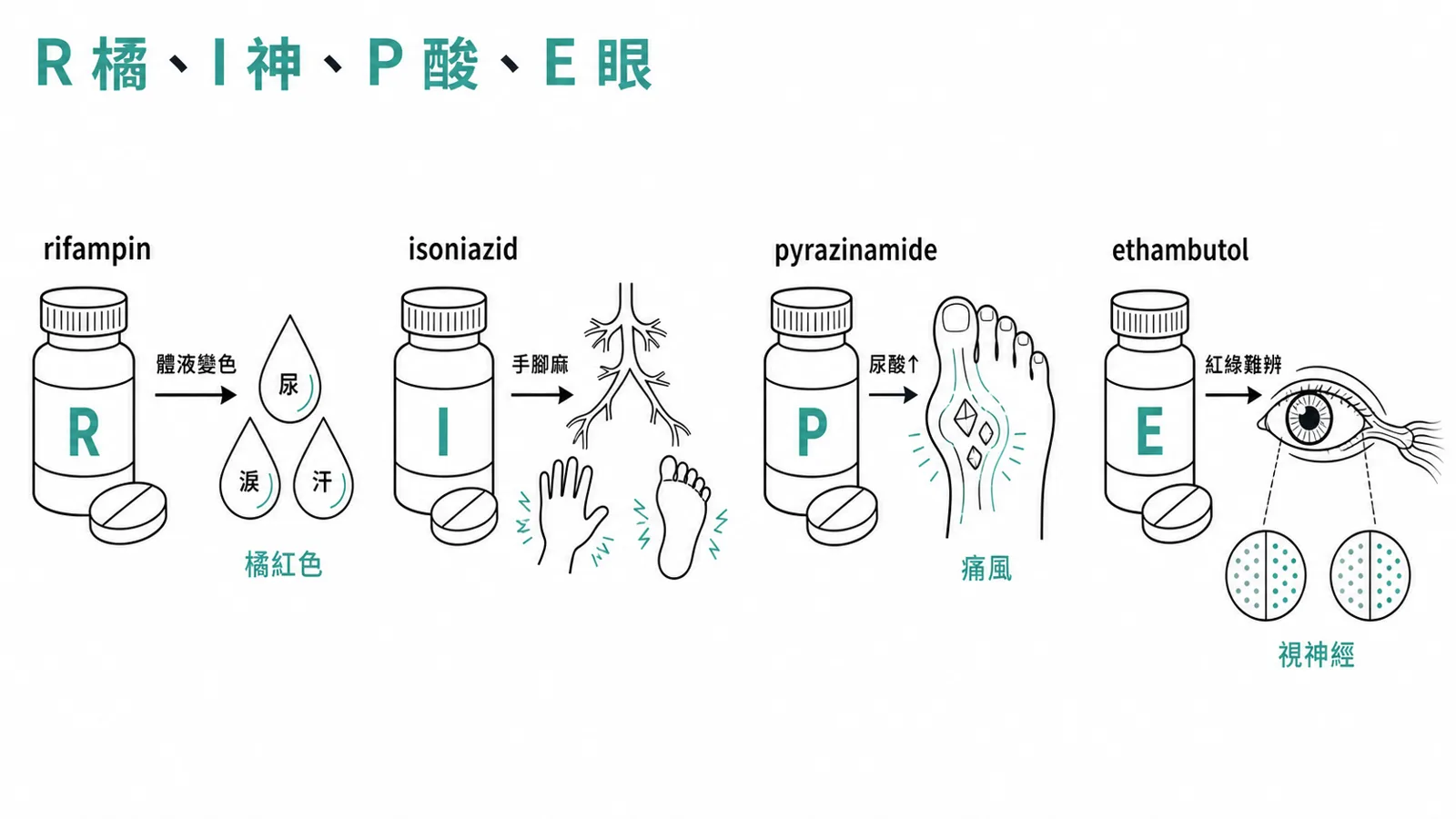 四個第一線抗結核藥的招牌毒性:rifampin 橘紅體液、isoniazid 周邊神經、pyrazinamide 高尿酸、ethambutol 視神經