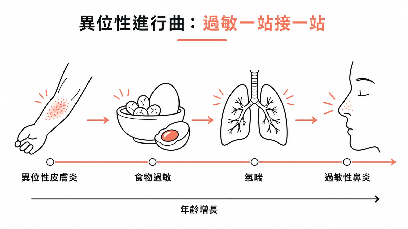 異位性進行曲:異位性皮膚炎、食物過敏、氣喘、過敏性鼻炎依年齡接續出現