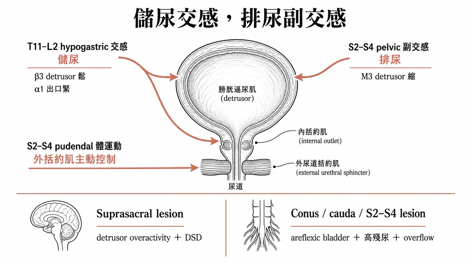 膀胱三套神經與病灶定位:交感儲尿、副交感排尿、陰部神經忍住;上位病灶過動失協調,下位病灶無反射高殘尿