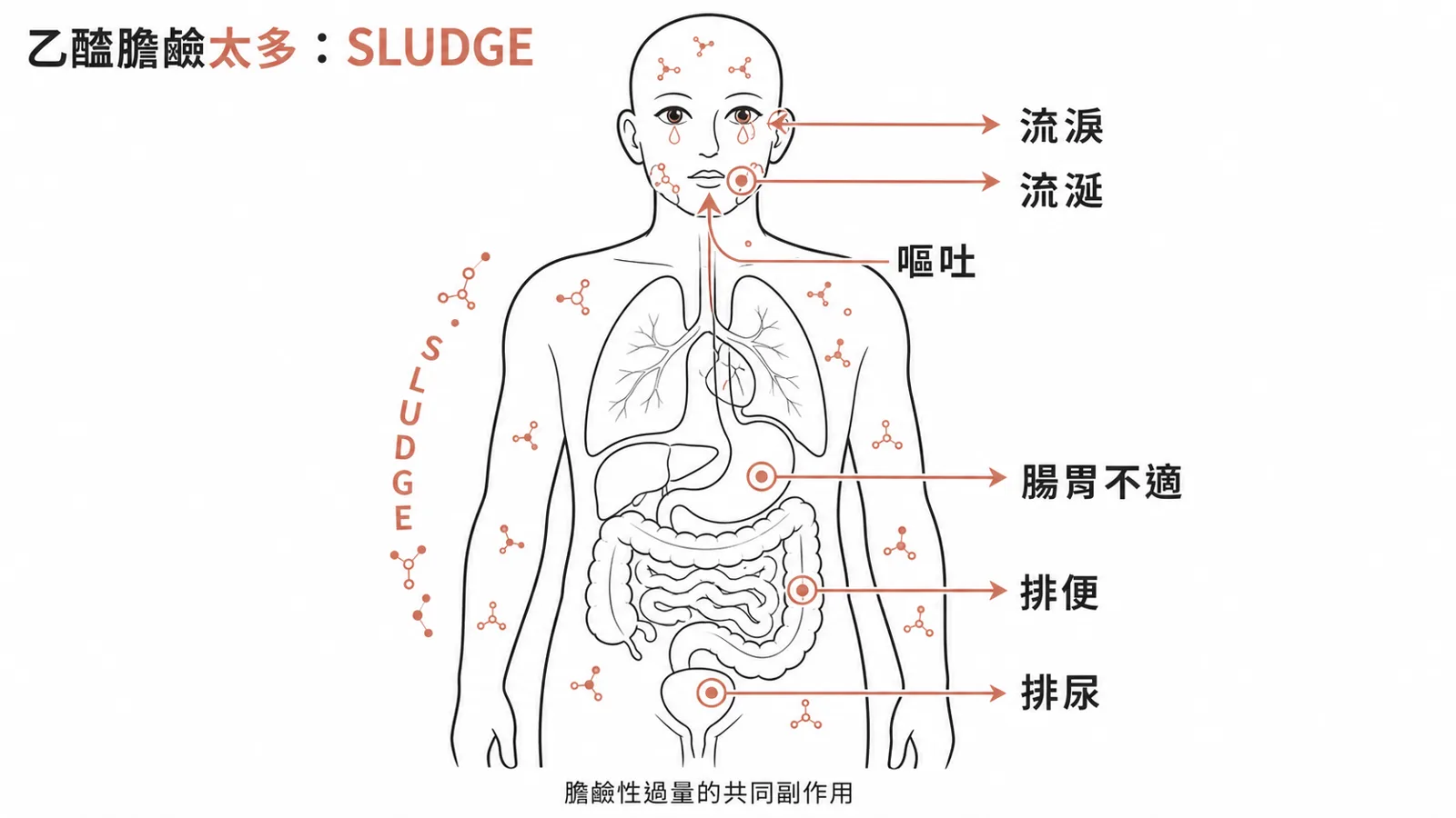 膽鹼性過量 SLUDGE：流涎、流淚、排尿、排便、腸胃不適、嘔吐