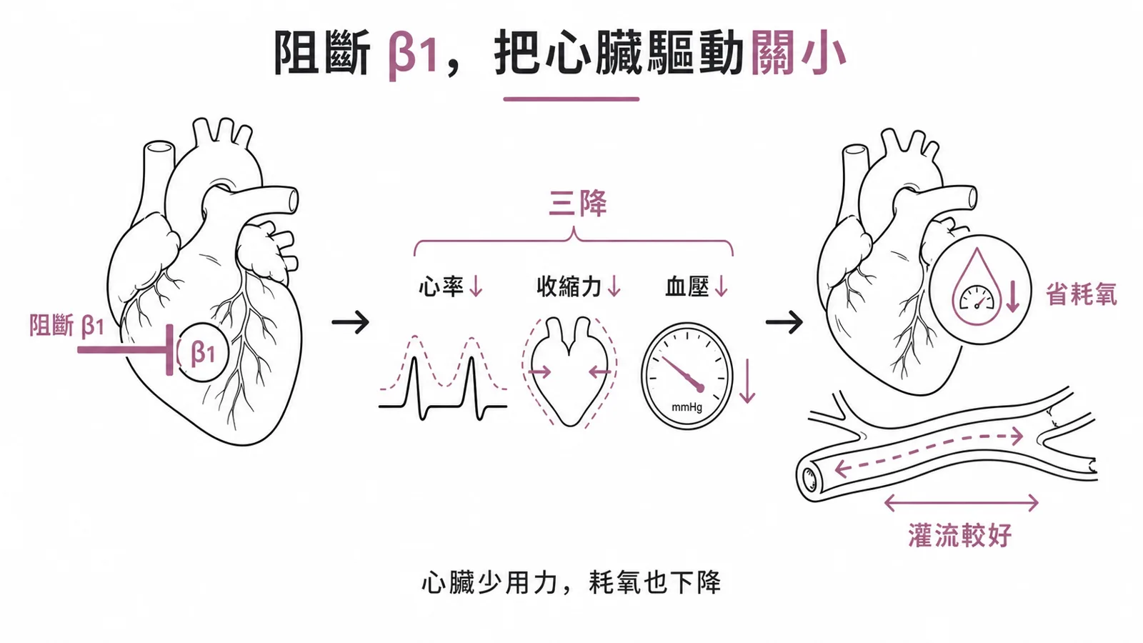 β-blocker 核心機轉：阻斷心臟 β1 受體，降心率、降收縮力、降血壓，減少心肌耗氧
