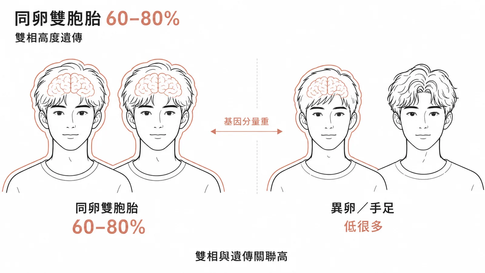 雙相情緒障礙症高遺傳性:同卵雙胞胎一致率約 60 到 80%,遠高於異卵雙胞胎與一般手足