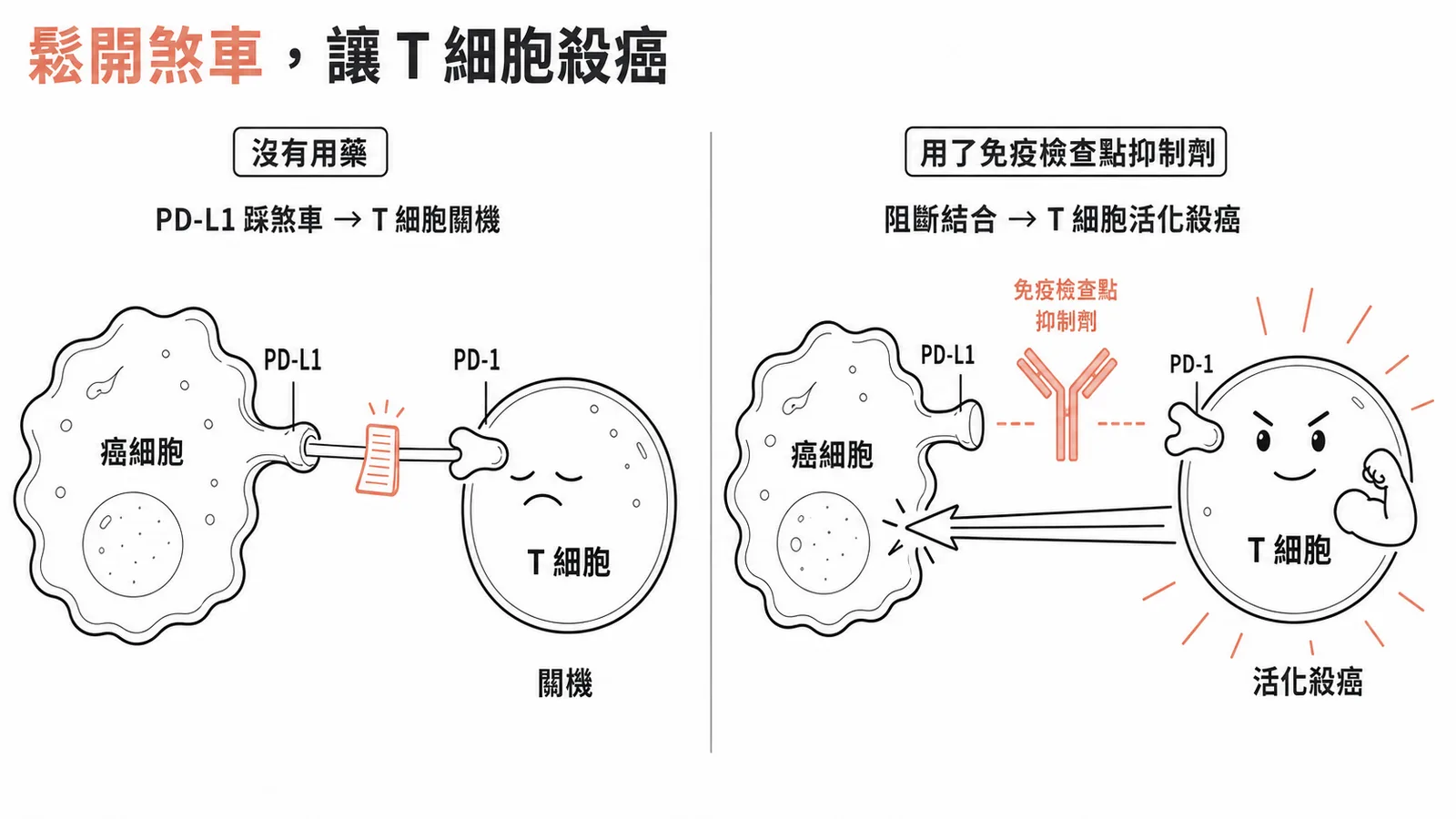 免疫檢查點機轉左右對照:癌細胞的 PD-L1 踩住 T 細胞的 PD-1 煞車、T 細胞被關機不殺癌;免疫檢查點抑制劑阻斷 PD-1 與 PD-L1 結合後、T 細胞重新活化攻擊癌細胞