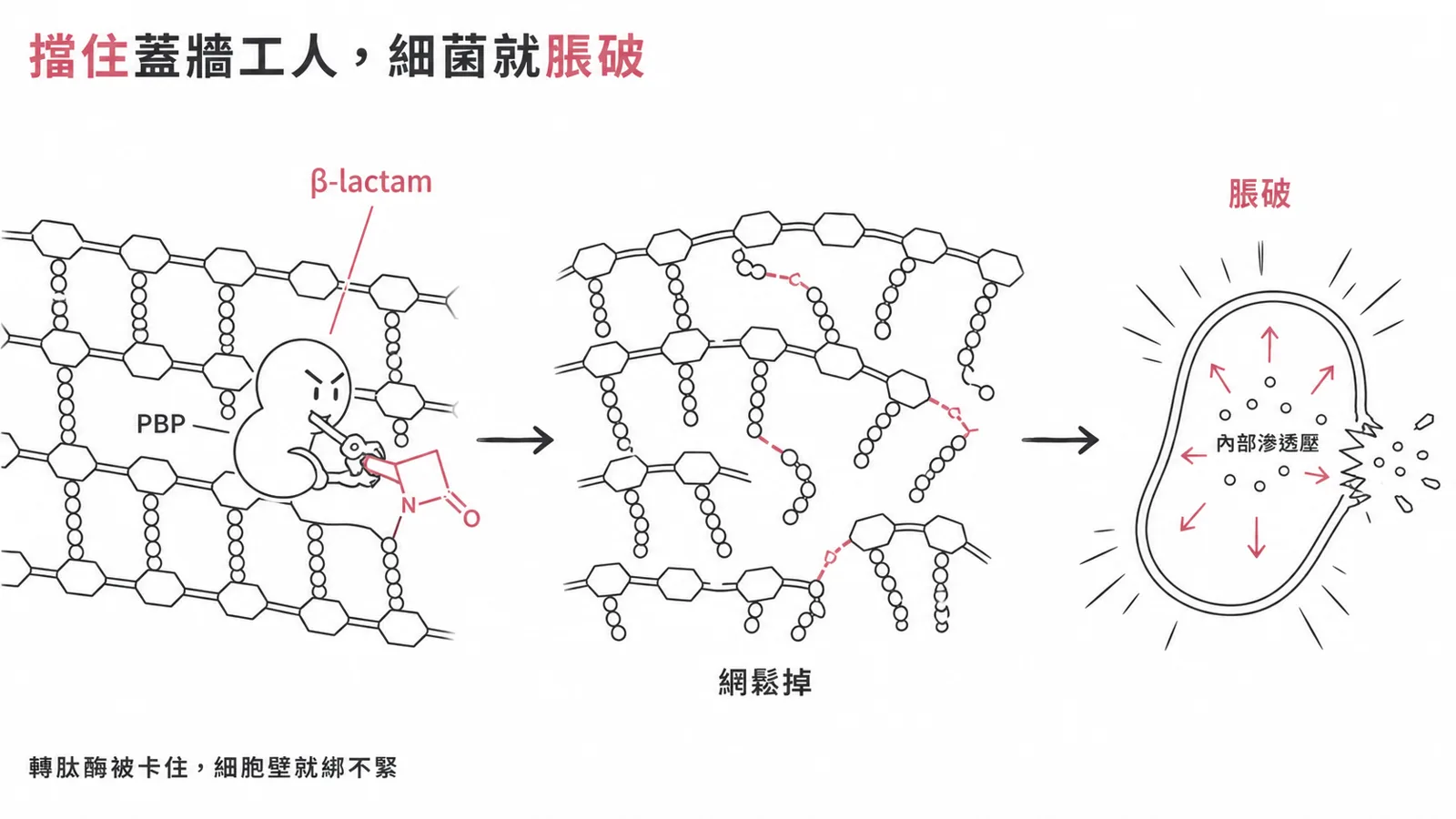 β-lactam 擋住轉肽酶(PBP),讓 peptidoglycan 無法交聯、細胞壁鬆掉、細菌脹破