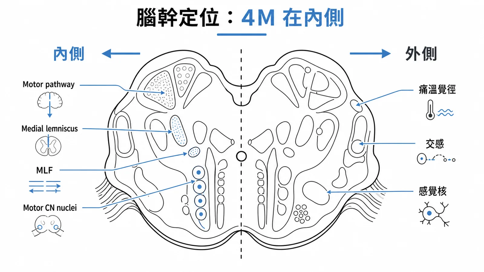 腦幹定位口訣:4M 在內側——Motor pathway、Medial lemniscus、MLF、Motor CN nuclei
