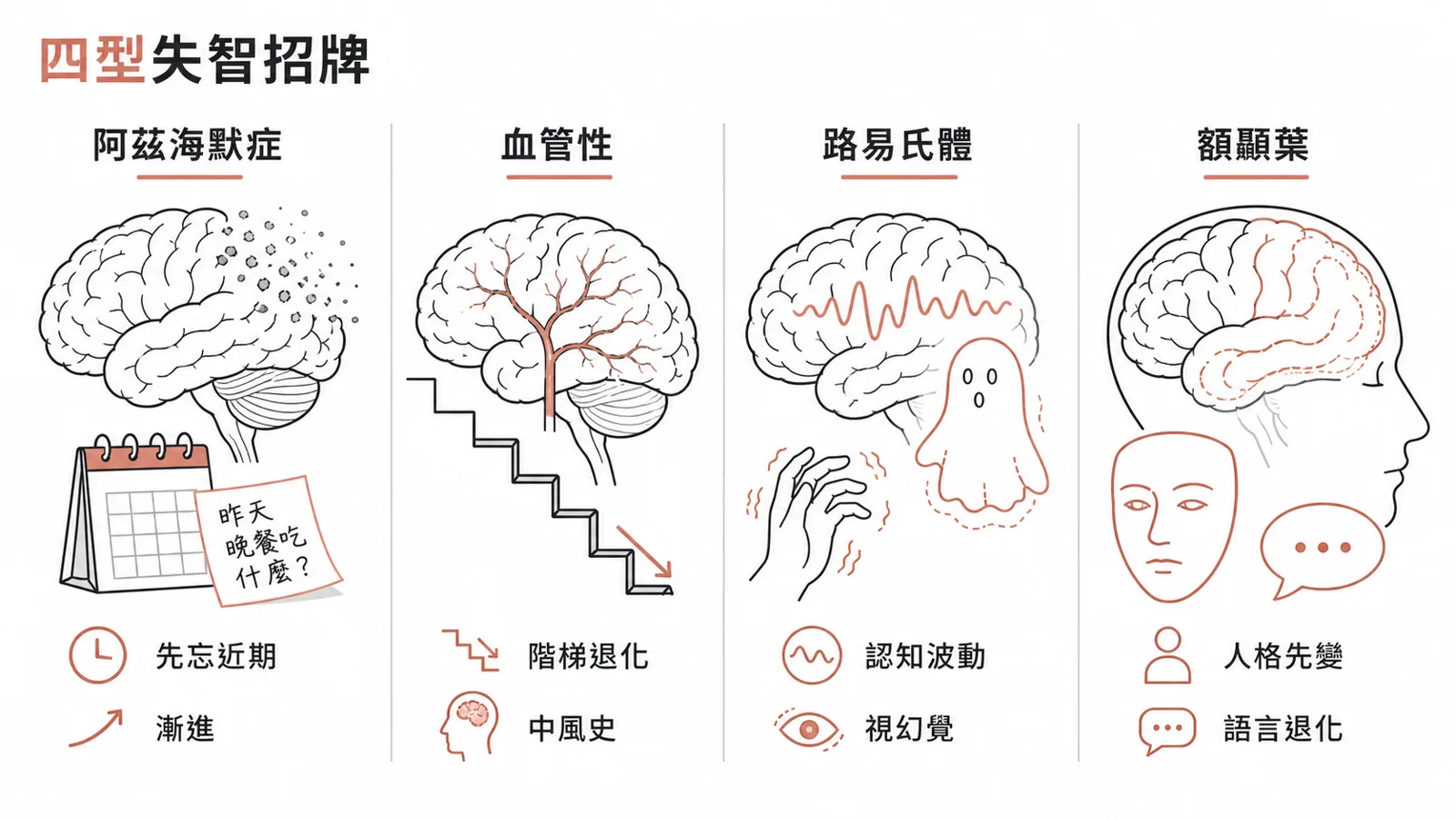 失智四大亞型招牌鑑別：阿茲海默慢忘、血管階梯、路易氏體波動視幻覺帕金森、額顳葉人格語言早發