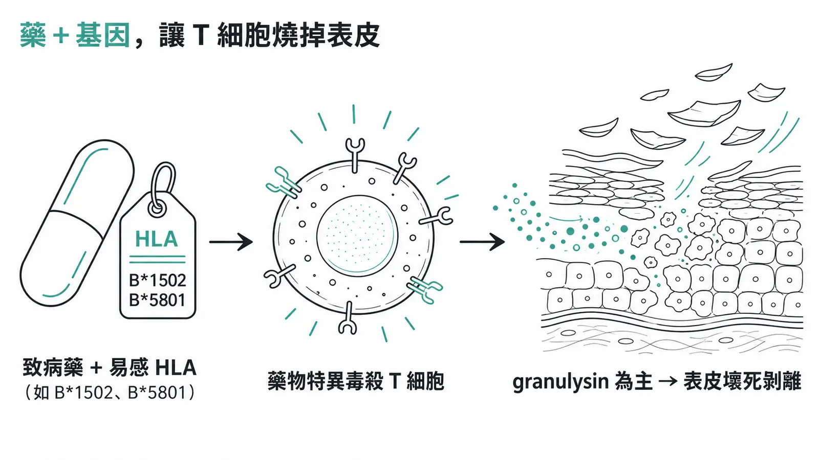 SJS/TEN 機轉流程:致病藥加上易感的 HLA 型別活化藥物特異的毒殺 T 細胞,釋放以 granulysin 為主的毒殺媒介,造成角質細胞大量凋亡與表皮壞死