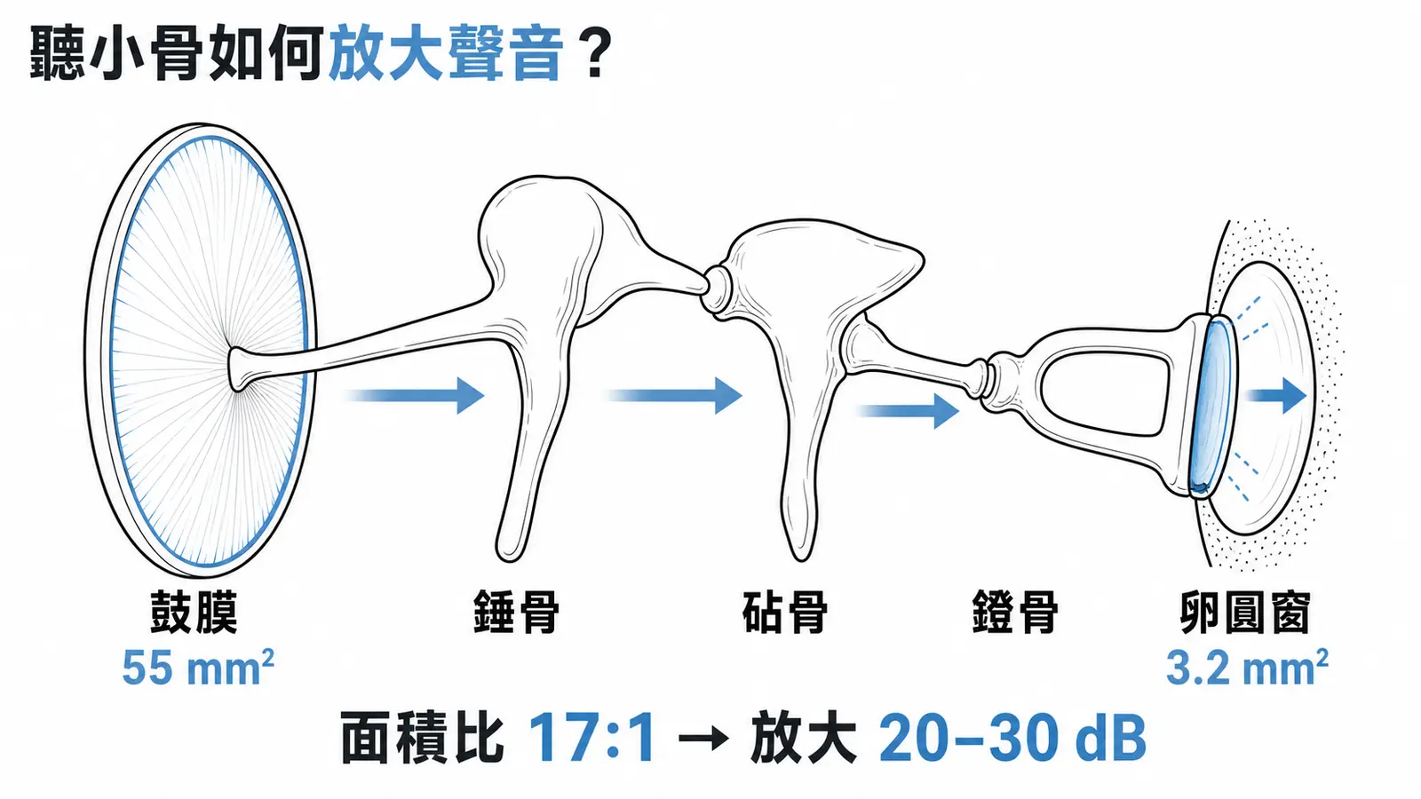 中耳聽小骨傳聲鏈示意圖：錘骨貼鼓膜、砧骨居中、鐙骨足板嵌入卵圓窗，標示面積比放大機制