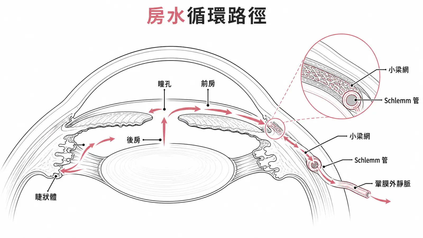 房水循環路徑示意圖:睫狀體分泌→後房→經瞳孔→前房→小梁網→Schlemm管→靜脈