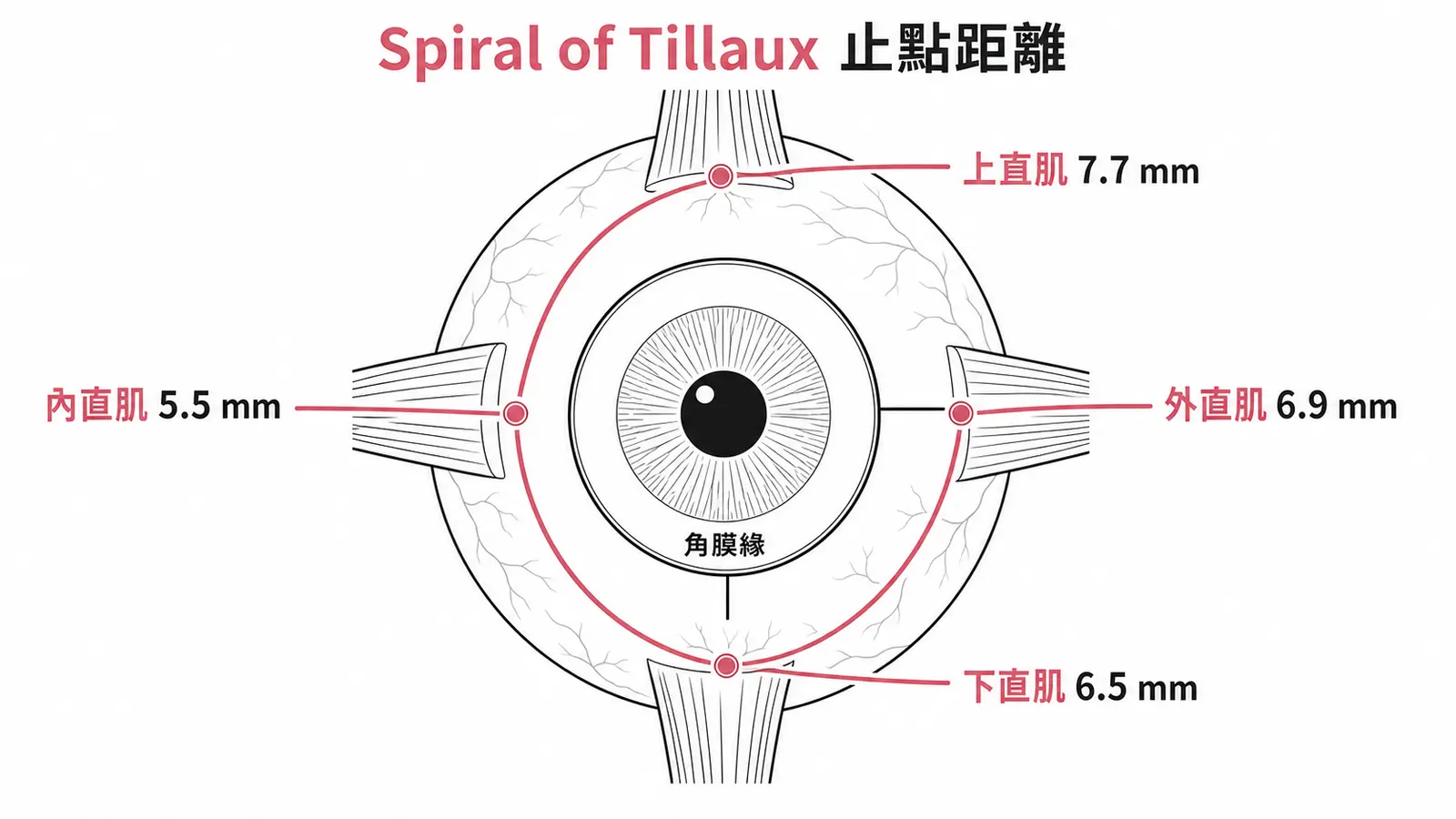 Spiral of Tillaux示意圖:四條直肌止點距角膜緣距離由近到遠為內直肌5.5mm→下直肌6.5mm→外直肌6.9mm→上直肌7.7mm