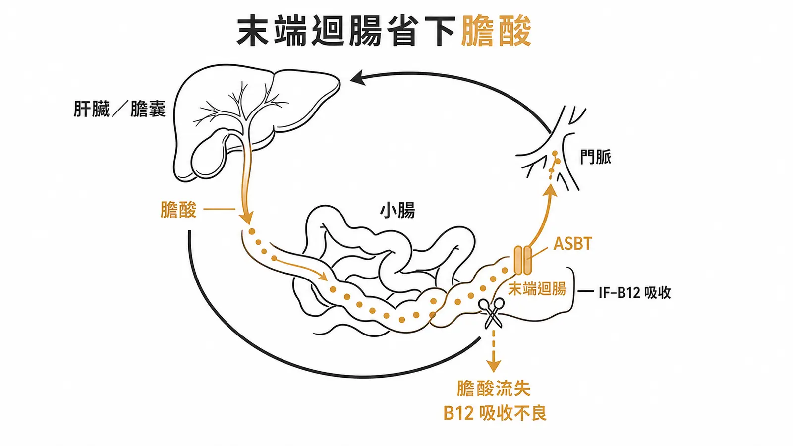 末端迴腸回收膽酸與維生素B12及切除後的吸收不良