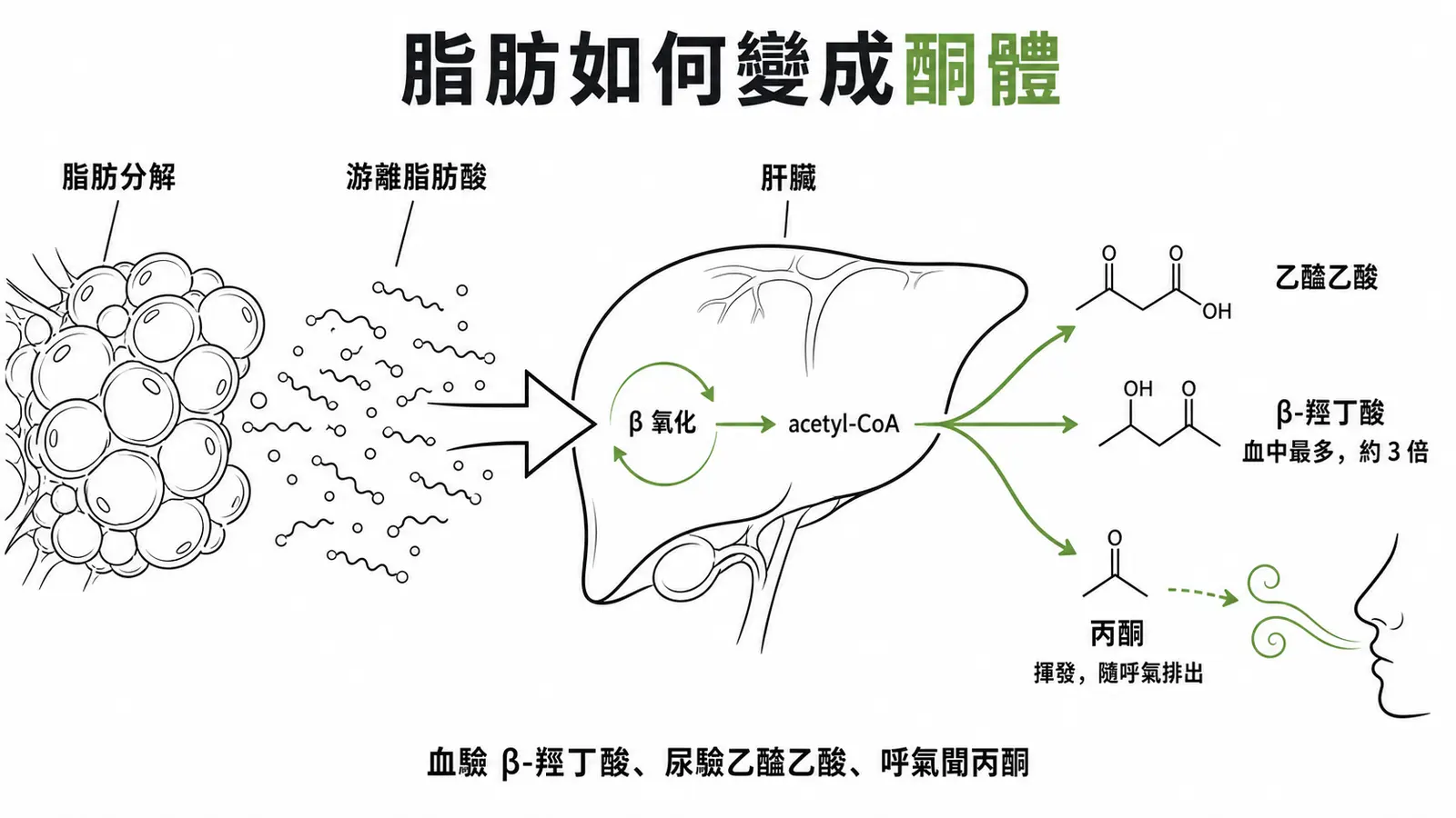 胰島素缺乏經脂肪分解生成三種酮體