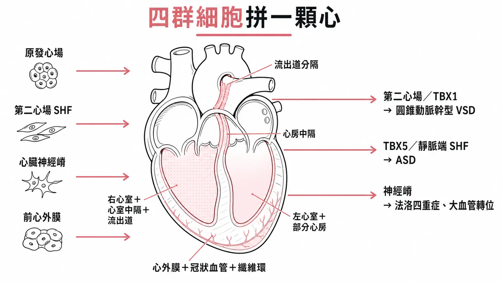 心臟發育的四群細胞來源與對應的先天性心臟病:原發心場貢獻左心室與部分心房,第二心場貢獻右心室、心室中隔與流出道,心臟神經嵴負責分隔流出道,前心外膜長出心外膜、冠狀血管與纖維環;第二心場與TBX1出錯對應圓錐動脈幹型VSD,TBX5與靜脈端第二心場對應ASD,神經嵴出錯對應法洛四重症與大血管轉位