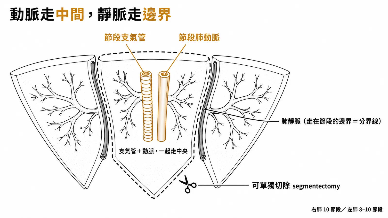 支氣管肺節段示意圖：節段支氣管與節段肺動脈並行走在節段中央，肺靜脈走在節段交界，單一節段可獨立切除