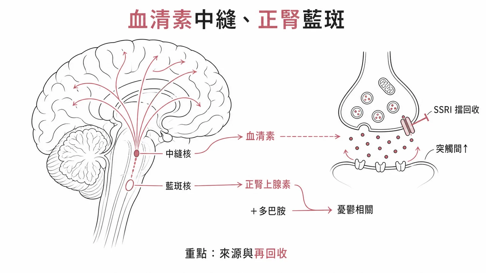 血清素中縫、正腎藍斑:MDD 的單胺假說與 SSRI 再回收機制