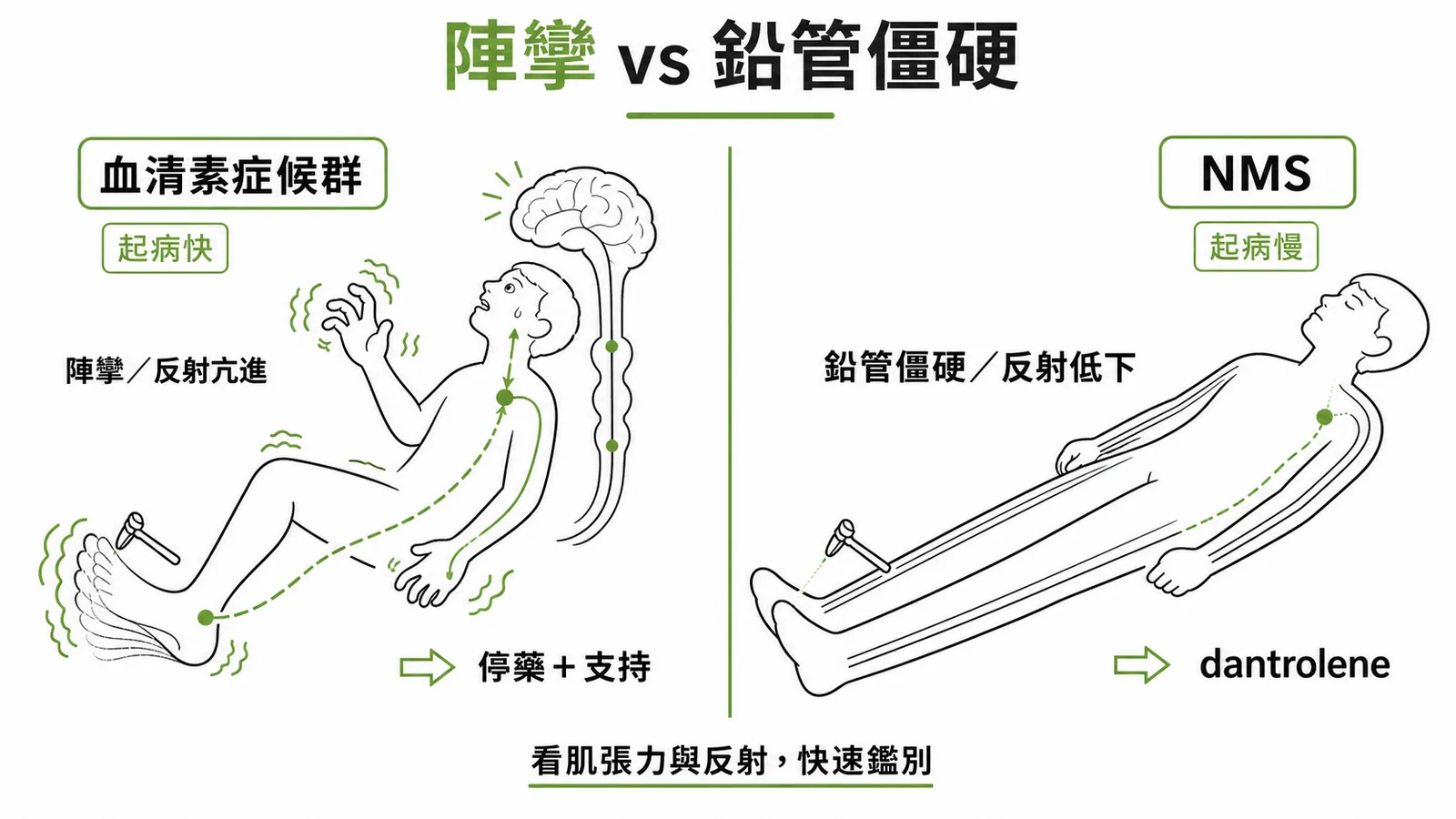 陣攣 vs 鉛管僵硬：血清素症候群與 NMS 的快速鑑別