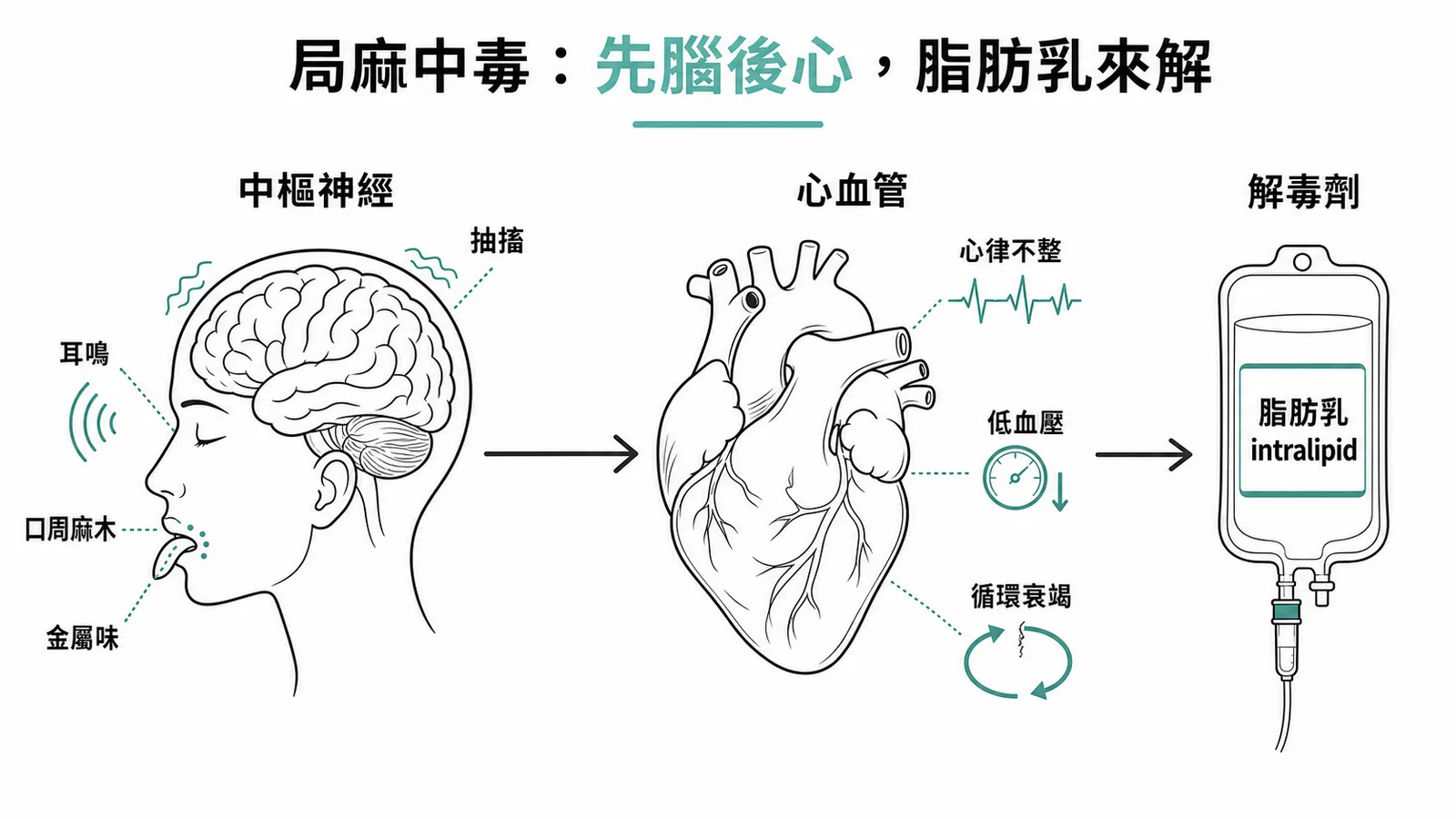 局部麻醉劑全身毒性(LAST)症狀時序:先中樞神經(口周麻木、金屬味、耳鳴、意識混亂、抽搐),後心血管(心律不整、低血壓、循環衰竭),專一解毒劑是 20% 脂肪乳 intralipid